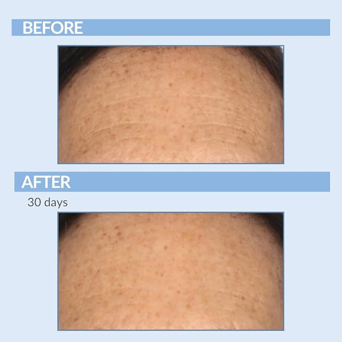 Retinol Fine Lines and Wrinkles Skin Care Set - A Force XR Serum and A Cream XR Moisture Cream for Face - Anti-Aging - Minimize Post Acne Marks - Resurface and Hydrate - Serious Skincare