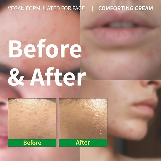 Panthenol Cream – Korean Skincare for Glass Skin with Airless Pump, 1.69oz | Hydrating Face Moisturizer with Centella Asiatica and Hyaluronic Acid | Soothing Barrier Repair Cream