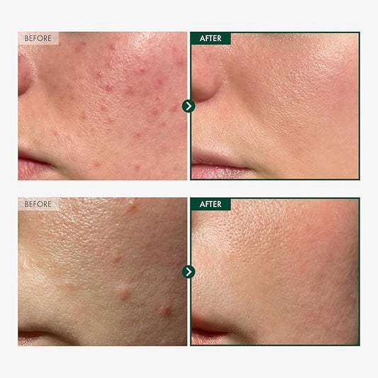 TOSOWOONG Madagascar Centella 86% Ampoule with 860,048ppm Centella Asiatica, Soothing, Calming, Facial Serum for face, for All Skin Types, Korean Skin Care, 100ml, 3.38 fl.oz.