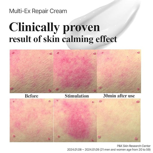 Multi-Ex Repair Cream 100ml – Korean Face Moisturizer with Niacinamide & EGF | Skin Repair Cream for Sensitive Skin | Soothing Facial Moisturizer for Women | Hydrating Moisture