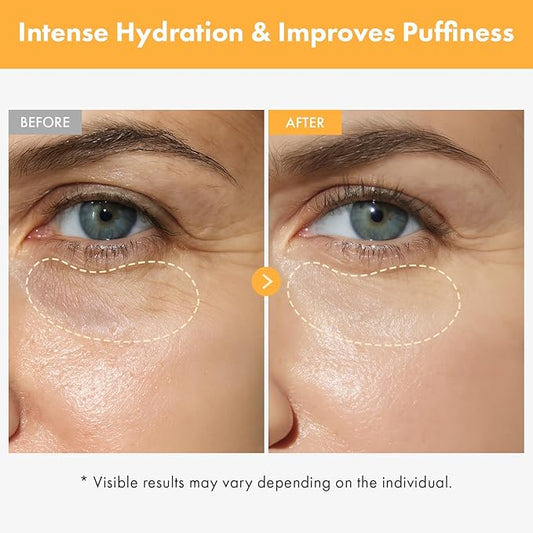 TOSOWOONG VITA Clinic Vitamin Eye Cream, Korean Skincare with 5% Arbutin, 2% Niacinamide, Hyaluronic Acid, Glutathione, Seabuckthorn Eye Serum for Fine Lines & Wrinkles, Puffiness, 15ml / 0.5 fl. oz.