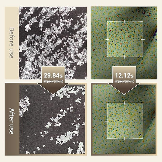 Benton Glycolic Acid 7% Exfoliating Toner with Niacinamide - Gentle AHA Toner for Brighter Skin & Even Tone - Balances Oil & Moisture - Hydrating, Cruelty-Free Korean Skin Care