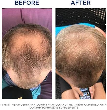 PHYTO Phytophanère 100% Natural Hair Loss Thinning Dietary Supplement, 4-Month Supply