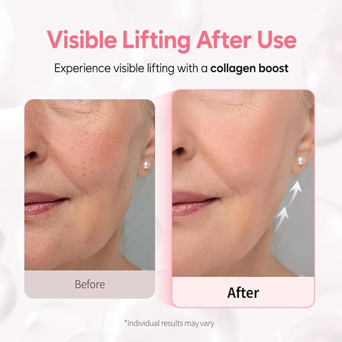 Overnight Collagen Lifting Gel Mask 5 pcs, Korean Face Lifting Deep Hydrogel Mask for Glass Skin, Anti-Aging with PDRN, Hyaluronic Acid for Elasticity, Firmness