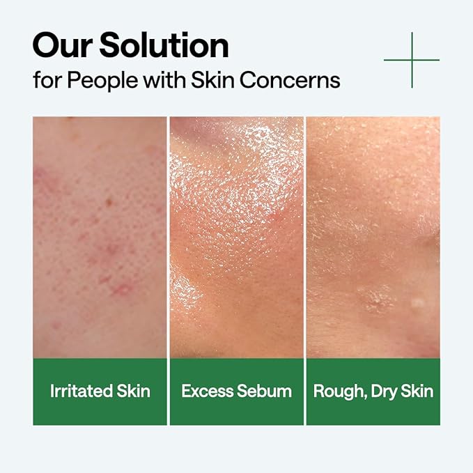 Mediheal Teatree Calming Serum 1.35 fl.oz - Quick Skin Calming and Redness Relief - Sebum Care, Oil Moisture Balance & Deep Moisturization with Hyaluronic Acid