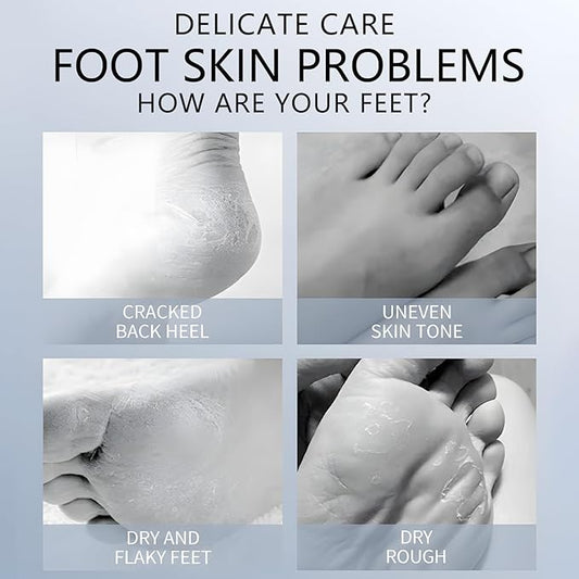 Foot Masks Moisturizing Socks - Moisturizes Tired, Dry & Cracked Feet, Exfoliating Hydrating Foot Mask - Dry Skin Solution - Moisturizing Foot Treatment- All Skin Types - 11Pairs