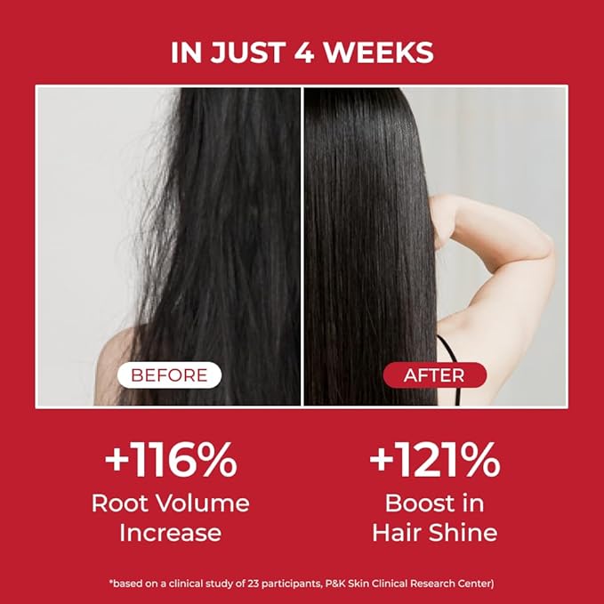 MOEV ANNURCATIN Shampoo | Korean Apple Hair Care for Strength and Volume in Thinning Hair | Adds Lift | Paraben-Free | Suitable for All Hair Types (10.14 fl.oz, apple & vanilla)