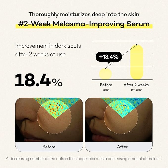 Vitamin C, Niacinamide Serum for Dark Spots, Uneven Tone & Radiance, Korean Glass Skin, Anti-Wrinkle, Collagen Serum, Vitamin Liposome, Moisturizer, Retinol Face Ampoule 30ml