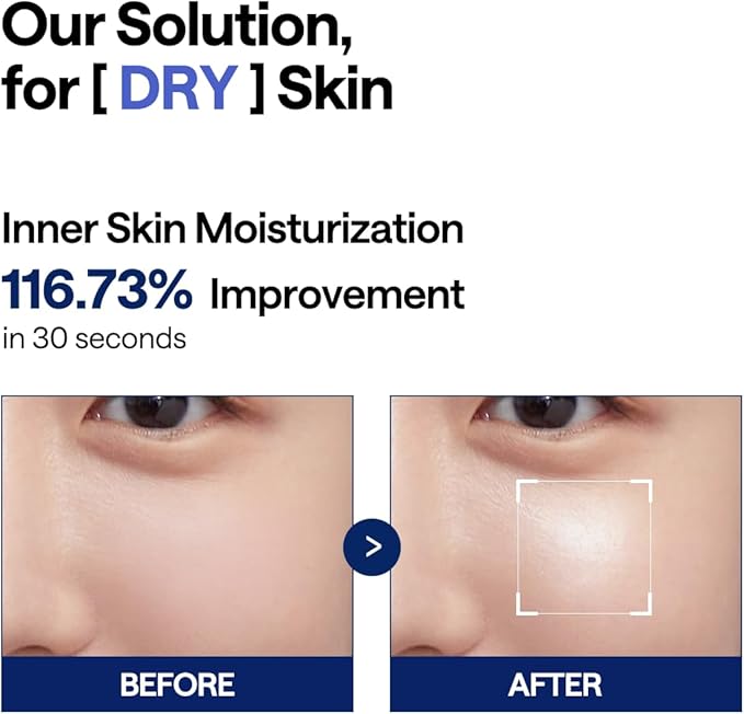 MEDIHEAL Watermide Moisture Pad - Square Cotton Facial Toner Pads with Icelandic Glacial Water - Improve Skin Temperature, Hydrating to Dry, Puffy, Coarse Skin -Vegan Eco Silk,100 Pads