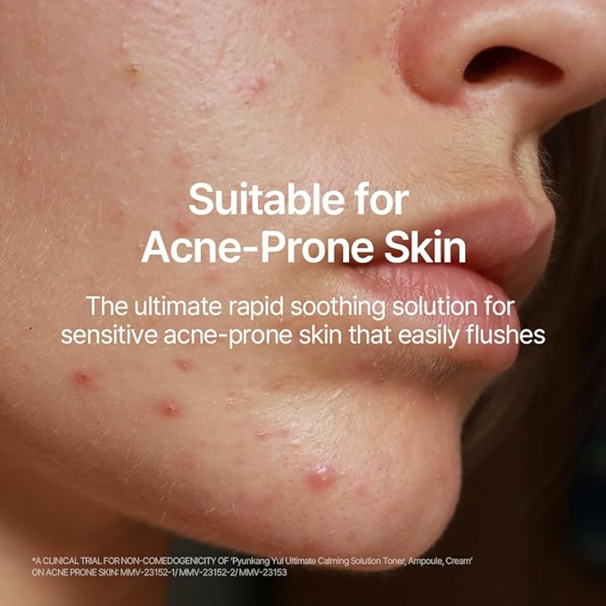 [PKY] Pyunkang Yul Ultimate Line Skincare Set, Soothing & Hydration Care, Calming Solution Toner, Ampoule & Cream, Traditional Korean-Style Packaging, Zero-Irritation (3-item set)