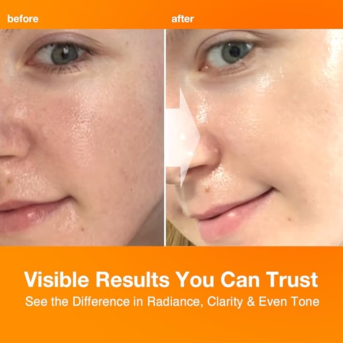 NIGHTINGALE C-TONING VITAMIN C SERUM For Face,Anti Aging and Skin Brightening with Vitamin C,Niacinamide, Hyaluronic Acid,Vitamin E,Adenosine,Reduces dark Spots, uneven skin Tone, 1.69fl.oz(50ml)