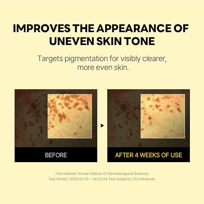 ROUND LAB Vita Niacinamide Dark Spot Serum 1.01 Fl Oz, Radiance-Boosting and Dark Spot Correcting Face Serum with Vitamin C, Improves Uneven Skin Tone, and Enhances Skin Clarity, Korean Skincare