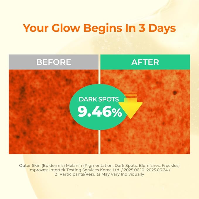 15% Niacinamide + Alpha Albutin + Banana PDRN Starry Niacin 15 Correcting Serum – Potent Brightening Serum for Uneven Tone & Dark Spots, Fragrance-Free | Korean Skincare (1.01 fl.oz / 30ml)