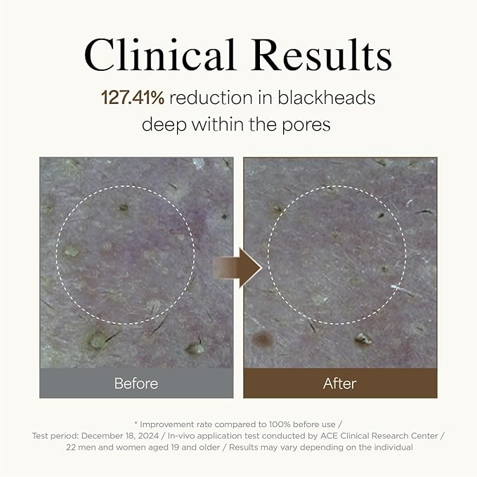 9Wishes Rice Foaming Cleanser - Pore Cleanser with Real Rice Powder for Gentle Exfoliation and Blackhead Removal, Korean Skin Care, 4 fl oz