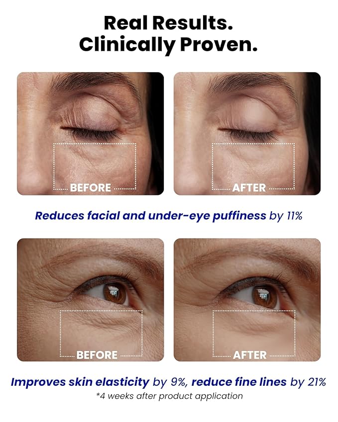 Ice Roll Serum - Cooling Serum with Face Massager Roller for Under Eye Bags, Puffiness, Dark Circles, Bakuchiol & Collagen for Wrinkles, Anti Aging, Firming - Korean Skin Care, 1.69 Fl Oz (50ml)