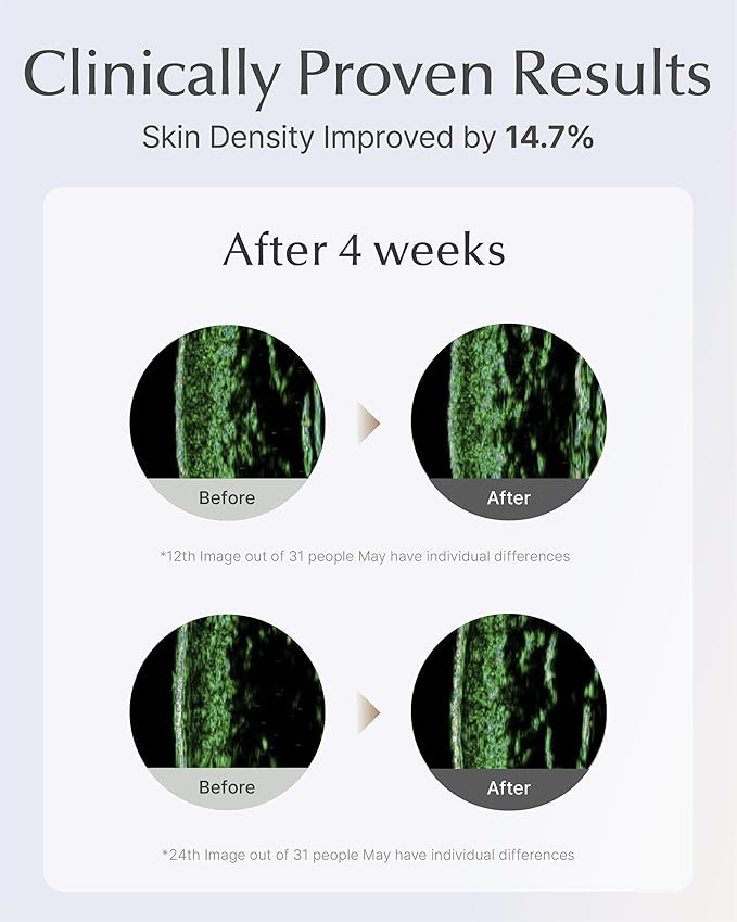 SOORYEHAN Lifting Ampoule Serum (2.02fl oz) - Triple-Action Anti-Aging Serum for Skin Tone, Texture, and Elasticity with 5% Niacinamide and Triple Collagen Blend