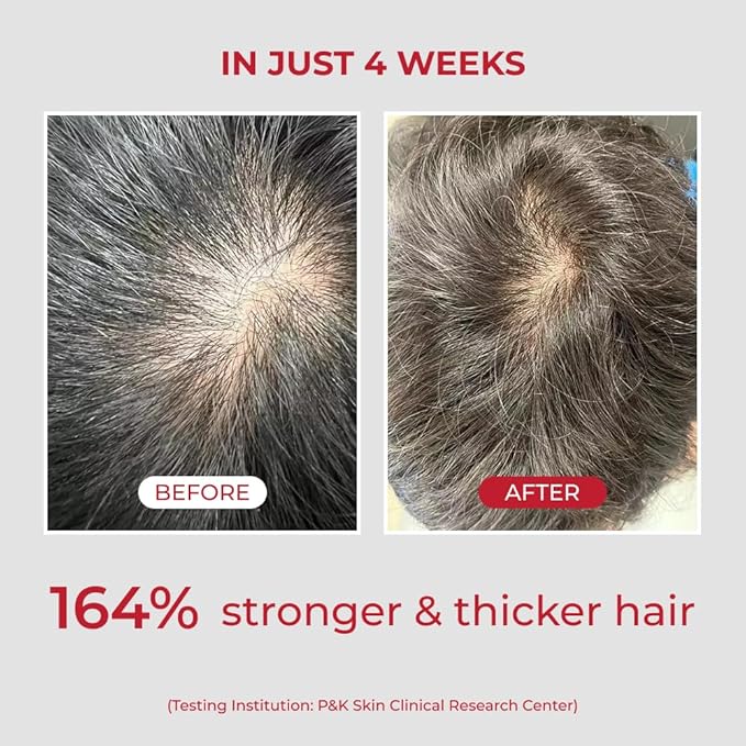 MOEV ANNURCATIN Shampoo | Korean Apple Hair Care for Strength and Volume in Thinning Hair | Adds Lift | Paraben-Free | Suitable for All Hair Types (10.14 fl.oz, apple & vanilla)