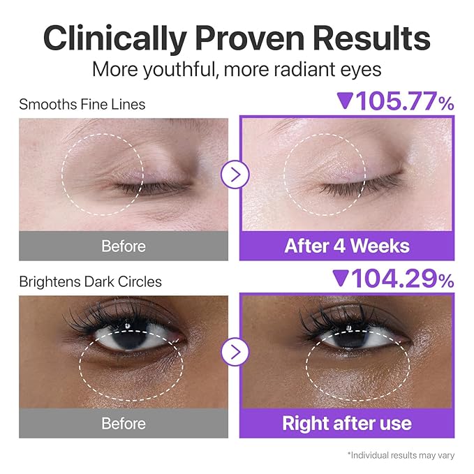 numbuzin No.9 Eye Cream | NAD+ Retinol Volumetox Eye Cream | Firming, Wrinkles, Fine Lines, Dark Circles, Depuff | Retinol, Peptides, Niacinamide | Restores Radiance for Undereyes | 0.33 fl. oz.
