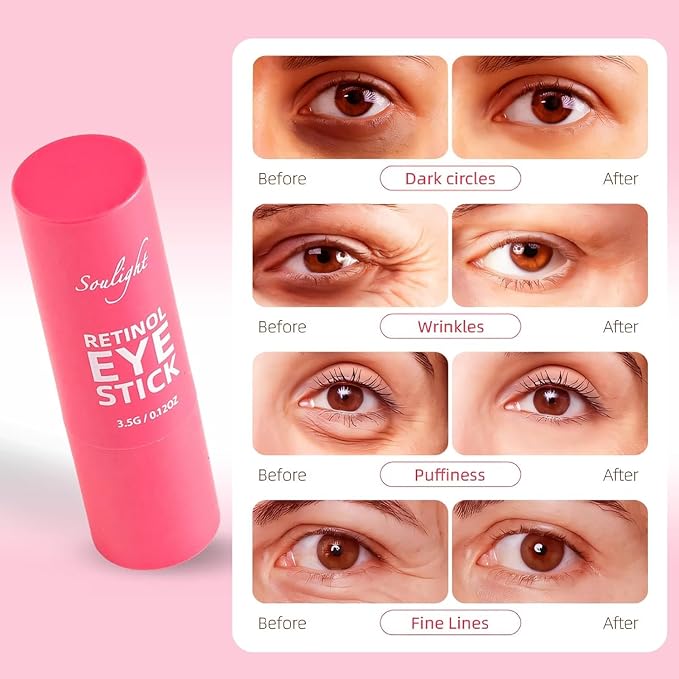 Soulight Retinol Eye Stick, Anti-Aging Eye Cream, Skincare for Wrinkles, Dark Circles, Puffiness - Retinol Eye Balm Moisturizes, Softens & Nourish Skin