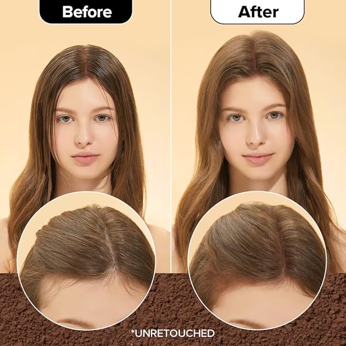 I DEW CARE Biotin Clarifying Dry Shampoo - Tap Secret Brown | Strengthening & Volumizing, Powder Type, Refillable, Travel size, Non-aerosol, Brunette, Korean Ginseng, 0.26 Oz