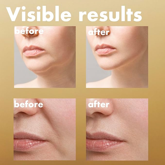 ISOI Intensive Lifting Serum, Premium Hydrating Serum for Skin Elasticity & Firmness, Instant Face Lift, Daily Care for Face & Neck, Korean Skin Care (1.18 fl. oz, 35ml)