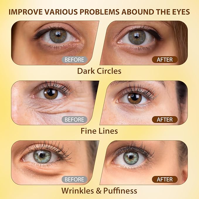 Soulight 5% Caffeine Eye Serum with Hyaluronic Acid & Vitamin C - for Dark Circles, Fine Line, Bag Treatment & Moisturizing | Under Eye Cream with 360° Roller Massage Ball