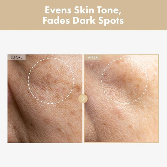 TOSOWOONG Rice Glow Milky Toner with 784,000ppm Korean Rice Water, Niacinamide, Ceramides, Panthenol, Glow, Glass Skin, Hydrating, Purifying, Fragrance-Free, Korean Skin Care, 250ml, 8.45 fl.oz.