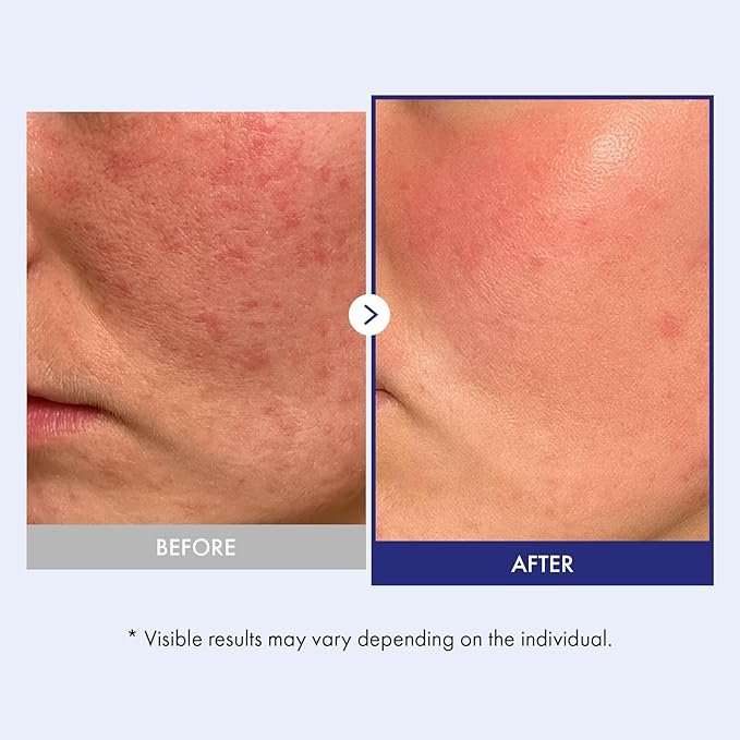 TOSOWOONG Panthenol 20 Barrier Cream, Daily Skin Barrier Care with 20% Panthenol, Ceramides, Hyaluronic Acid, Deep Hydration, Face Moisturizer, Korean Skincare for All Skin Types, 50ml / 1.69 fl. oz.