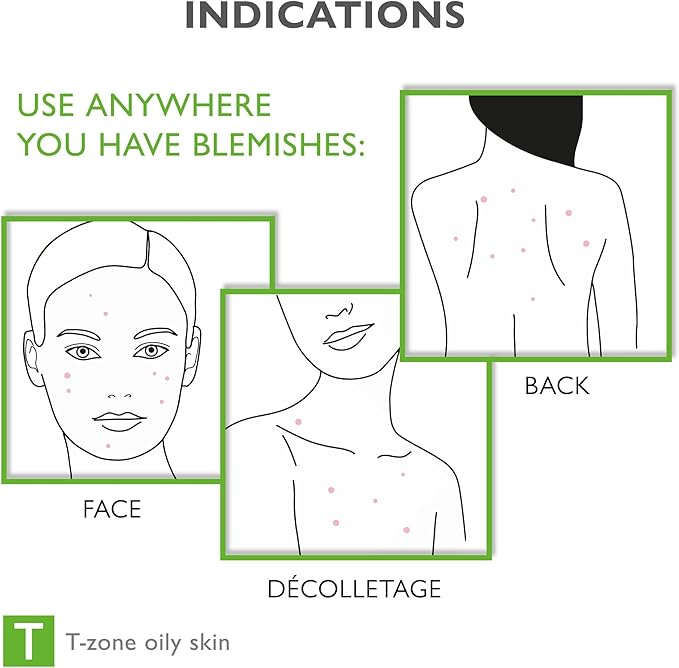 Pharmaceris Face & Body Breakout Solution - 3% Mandelic Acid Helps Clarify Blemish & Acne Prone Skin, Face, Back & Chest Pimples Exfoliating & Clearing Treatment, SEBO-ALMOND-CLARIS, 6.42 fl oz