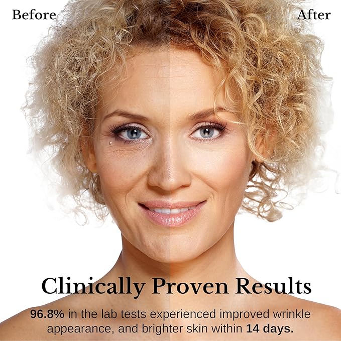 Lamelin Wrinkle Serum Cream, Retinol & Bakuchiol & Niacinamide, 10 Vitamins & Herbs, Antioxidant, Eye Bag Dark Neck Correction, Day & Night Skin Brightening, 1.76 Fl Oz. Made in Korea