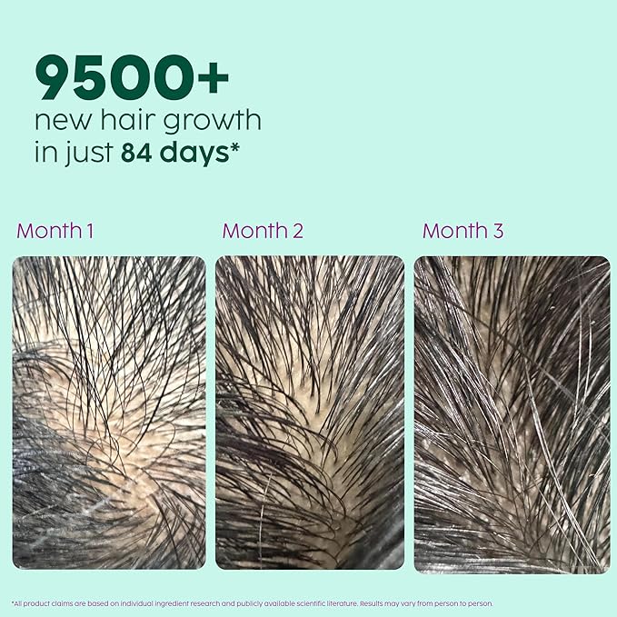 PLI.X - THE PLANT FIX Rosemary Hair Growth Serum with 3% Redensyl,4% AnaGain, 3% Baicapil,| Stimulates Hair Growth, improves hair Density & Thickens Hair | For Men & Women - 1.01 Fl Oz (30ml)