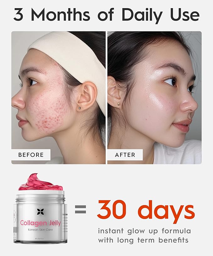 REVO Collagen Jelly – Korean Anti-Aging Plumping Formula with Hydrolyzed Collagen, Niacinamide, Hyaluronic Acid & Vitamin C – Skincare for Glass Glow Skin, Wrinkle Repair & Even Tone (3.52 Fl Oz)