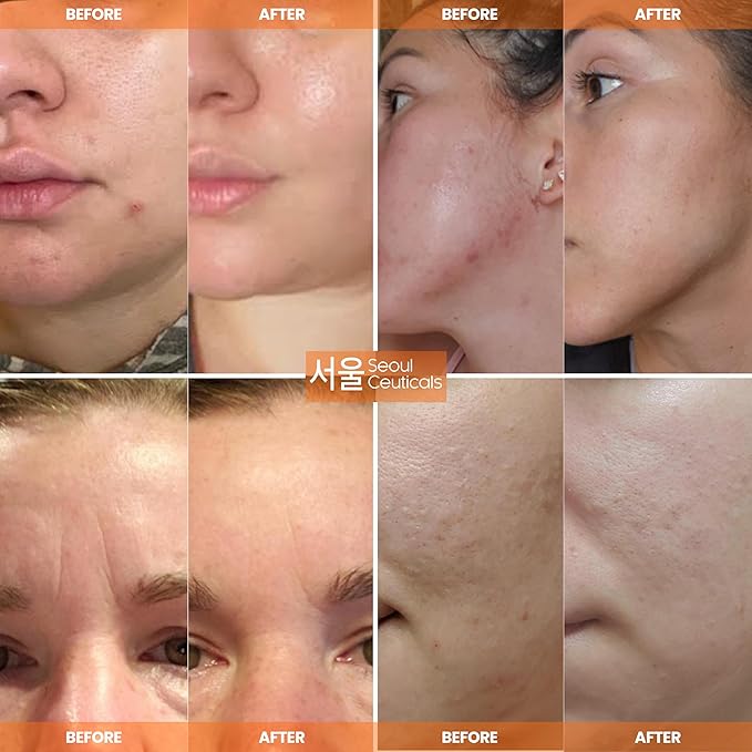 SeoulCeuticals Korean Skin Care 97.5% Snail Mucin Moisturizer Cream - K Beauty Skincare Day & Night Snail Repair Cream Filtrate Cruelty Free 2oz