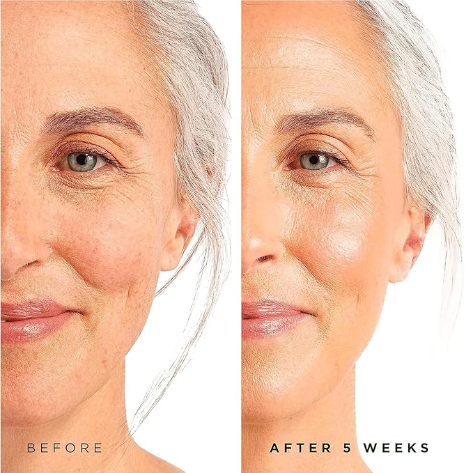 Tree of Life Beauty Retinol Serum, Skin Smoothing Face Oil for Dark and Age Spots and Fine Lines, Facial Serums for Dry and Sensitive Skin Care with Hyaluronic Acid for Soft Skin, 2 Fl Oz (pack of 2)