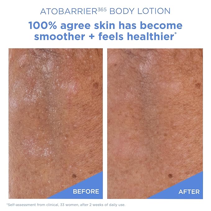 AESTURA ATOBARRIER365 Korean Body Lotion with Ceramides | Fast-Absorbing Moisturizer for Dry, Sensitive & Eczema-Prone Skin | Non-Comedogenic, Fragrance-Free, 400 mL / 13.5 fl oz