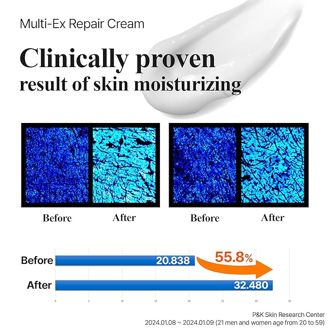 Multi-Ex Repair Cream 100ml – Korean Face Moisturizer with Niacinamide & EGF | Skin Repair Cream for Sensitive Skin | Soothing Facial Moisturizer for Women | Hydrating Moisture