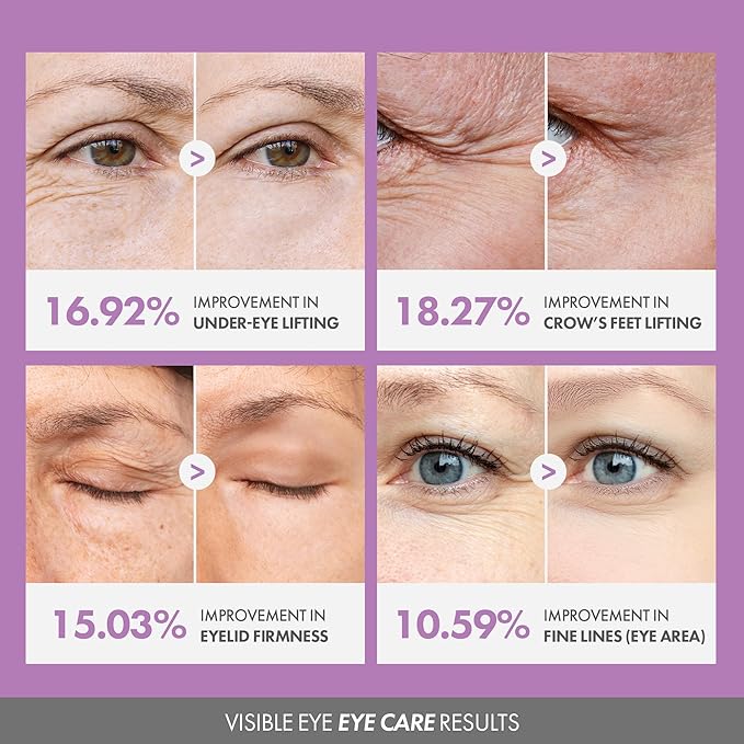 KAHI Eye Balm CV Refill - Age-Defying, Hydrating, 3D Lifting Under Eye Moisturizer Stick with Beluga Caviar Oil - Corrector for Dark Circles – Luxury Korean Skincare (9g, 0.31 oz)