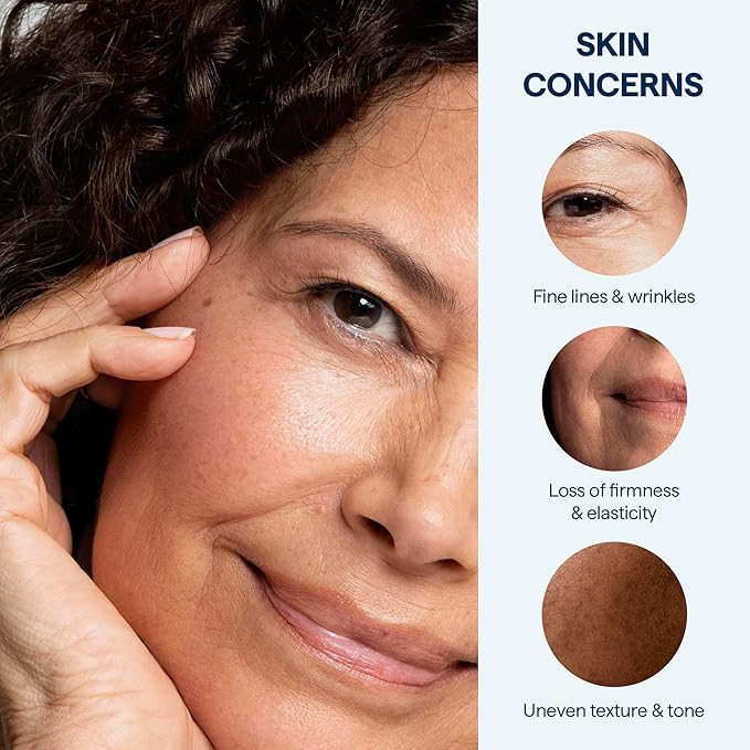 Remedy for Healthy Aging - Retinaldehyde, Resveratrol, Glycolic Acid, Argireline, Ferulic Acid, Matrixyl 3000 - Anti-Aging Treatment for Wrinkles, Uneven Texture & Tone - By Dermatologist Dr. Shah