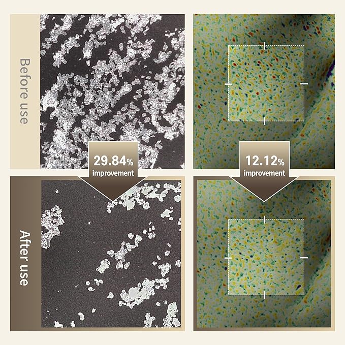 Benton Glycolic Acid 7% Exfoliating Toner with Niacinamide - Gentle AHA Toner for Brighter Skin & Even Tone - Balances Oil & Moisture - Hydrating, Cruelty-Free Korean Skin Care