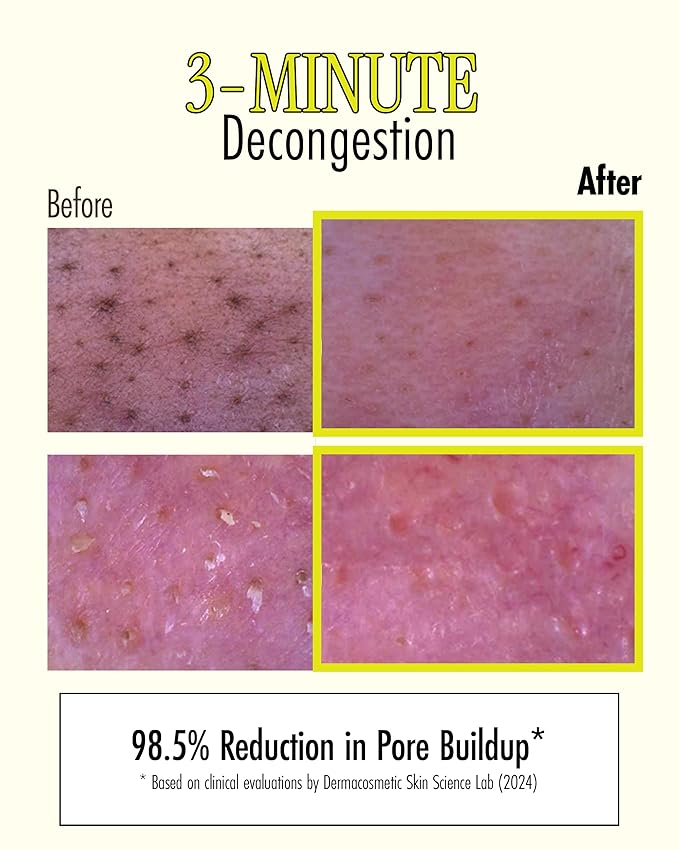 BRMUD Relief Mud Stick Mask | ATEEZ Pick- 3-Minute Pore Mask Skincare w/Boryeong Mud, Tea Tree Oil & PHA – Absorbs Oil, Decongests Pore & Smooths Skin – Korean Clay Stick Mask (1.05 oz)